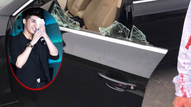 Thực hư hình ảnh cánh tay rỉ máu được quản lý Noo Phước Thịnh chia sẻ khiến fan hoang mang tột độ? Ảnh 2