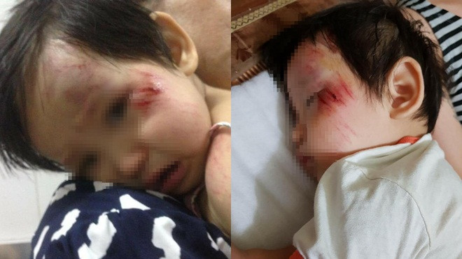 Tông bị thương bé 11 tháng tuổi, thanh niên chối tội vờ làm người đi đường chạy đến giúp đỡ Ảnh 2