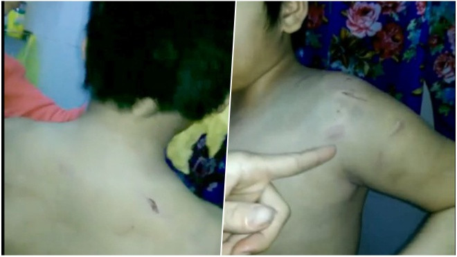 Bé trai 9 tuổi bị mẹ và dì hành hạ đến nhập viện vì 'đọc kinh không thuộc' Ảnh 2