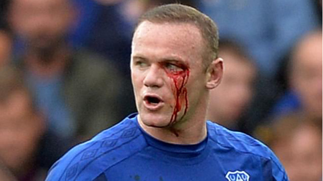 Máu trên mắt Rooney và 'chiêu độc' của Mourinho Ảnh 2