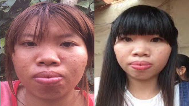 Chuyện tình nhanh như chớp của 'Thị Nở tái sinh' với trai tân 28 tuổi Ảnh 2