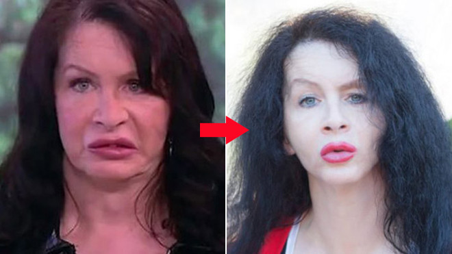 Muốn trẻ mãi với thời gian, nữ diễn viên tự tiêm vi khuẩn 3,5 triệu năm vào cơ thể Ảnh 2