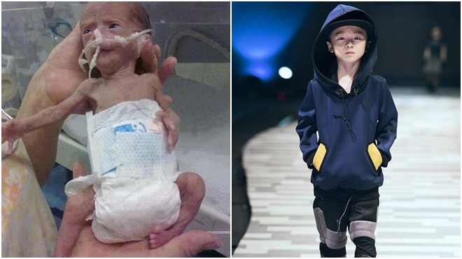 Câu chuyện ấm áp của cậu bé 6 tuổi khi sinh chỉ nặng 1.2kg qua lời kể của mẹ Ảnh 2