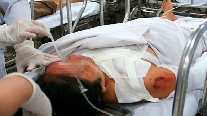 Cụ ông tạt axít người tình kém 22 tuổi vì ghen Ảnh 2