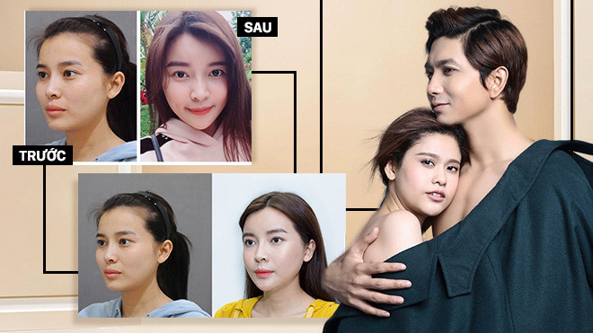 Tim ủng hộ Trương Quỳnh Anh tu sửa vòng 1, Người đẹp xứ Dừa 'đập mặt xây lại' Ảnh 2