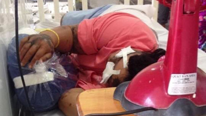 Nữ kế toán trường quốc tế bị tạt axit trên đường Ảnh 2