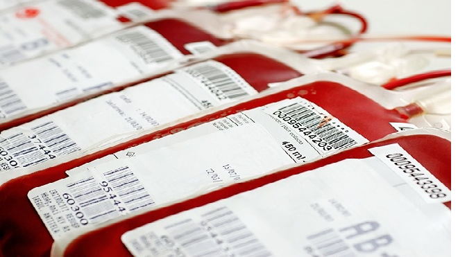 Điểm danh những loại chất lỏng đắt nhất hành tinh, có thứ chúng ta dùng hàng ngày đấy Ảnh 2