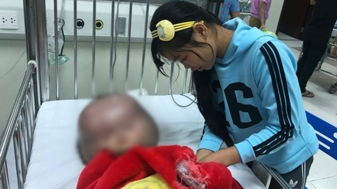 Xót xa bé trai 12 tháng tuổi mắc bệnh não úng tủy, đầu nặng gấp 3 lần cơ thể Ảnh 2