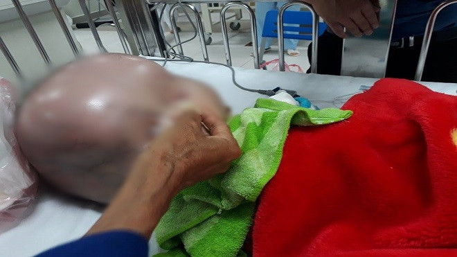 Mẹ bé trai bị não úng thủy: 'Mọi người ủng hộ chi phí đi Singapore chữa bệnh nhưng tôi không đồng ý' Ảnh 2