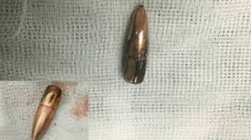 Nghi vấn đạn lạc rơi trúng cổ nam thanh niên nằm trong nhà ở Hoà Bình Ảnh 2