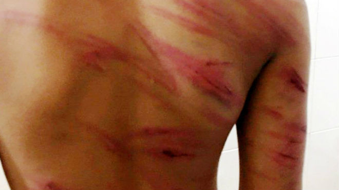 Bé trai 8 tuổi bị cha dượng đánh nhập viện, mẹ đẻ thờ ơ như không có chuyện gì Ảnh 2