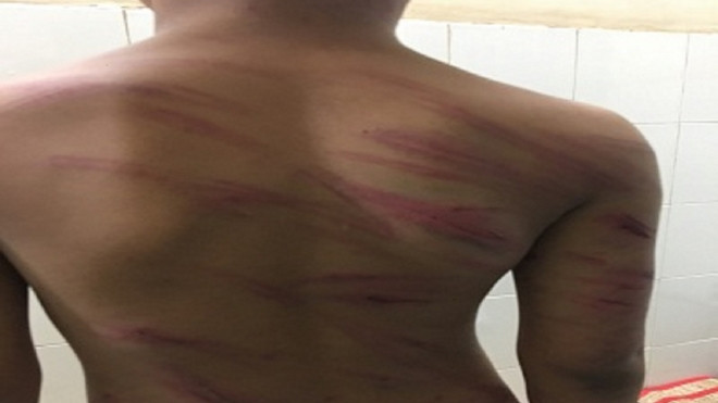 Khởi tố cha dượng bạo hành dã man bé trai 8 tuổi Ảnh 2