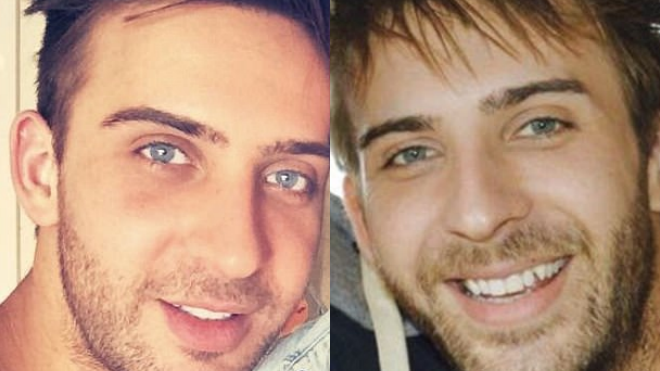 Ám ảnh sắc đẹp, anh chàng chi 8.000 USD mỗi năm để phẫu thuật, tiêm botox Ảnh 2