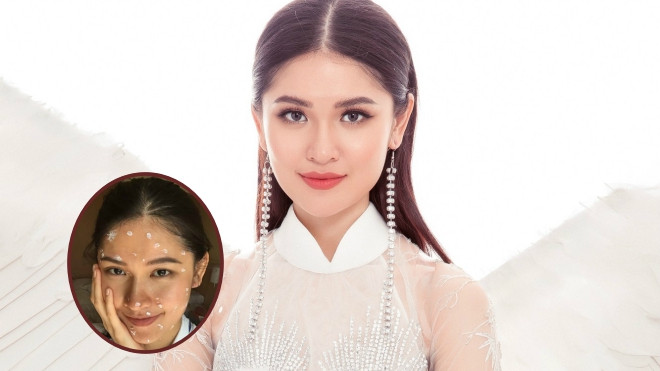 Á hậu Thuỳ Dung bị bệnh thuỷ đậu ngay trước thềm chung kết Miss International 2017 Ảnh 2