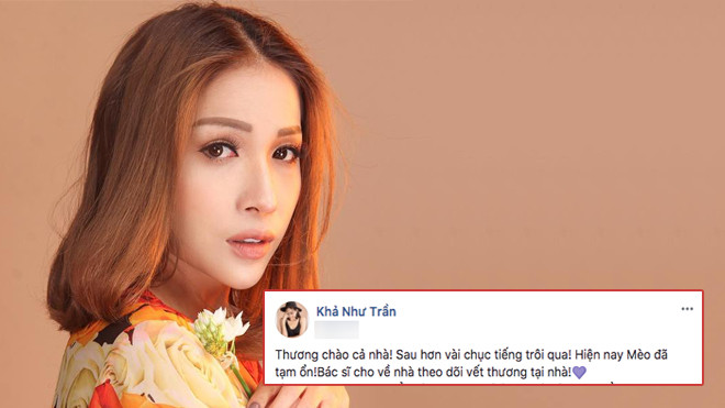 Sau 1 ngày im lặng, Khả Như lên tiếng trước sự cố bị bỏng nặng khi tập kịch Ảnh 2