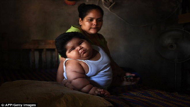 Em bé 10 tháng ở Mexico nặng 28kg, mẹ cứ ngỡ do sữa tốt nhưng không ngờ sự thật phía sau Ảnh 2