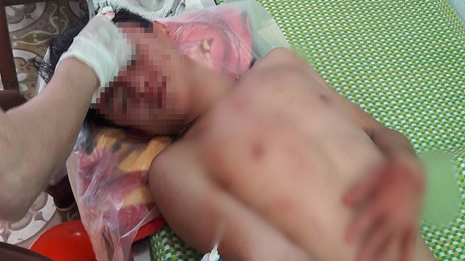 Nhóm đối tượng vào trường học gây rối, đánh thầy và trò nhập viện Ảnh 2