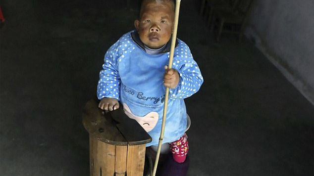 Người đàn ông 30 tuổi bị 'mắc kẹt' trong hình hài một đứa trẻ Ảnh 2