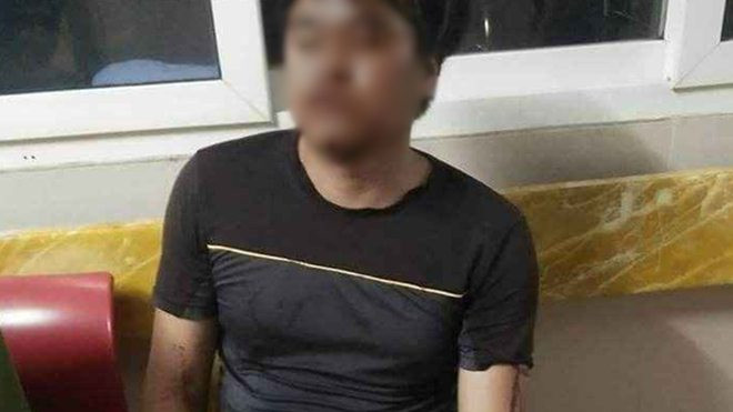 Bị truy đuổi, ‘cẩu tặc’ dùng súng hoa cải bắn trọng thương 2 người dân Ảnh 2