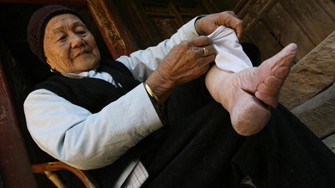 'Bó chân gót sen': Đẹp ở đâu khi bàn chân rỉ máu, biến dạng cả đời? Ảnh 2