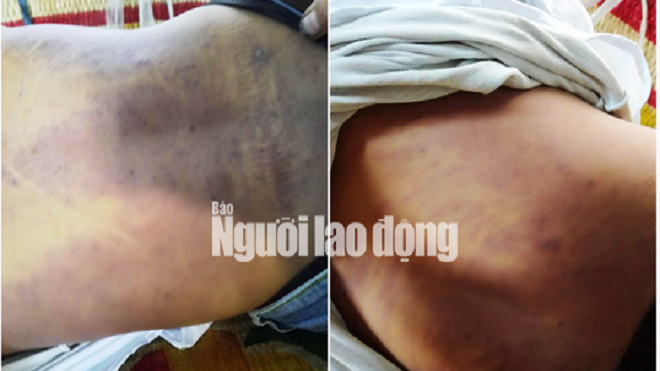 Tử vong sau khi bị công an bắt Ảnh 2