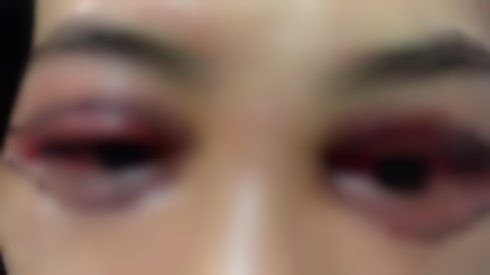 Bị khách tố làm hỏng mí mắt còn bắt livestream xin lỗi, chủ spa nói gì? Ảnh 2