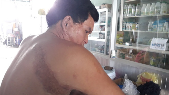 Lật lại vụ đại gia nước đá Cần Thơ bị tạt a xít: 3 năm chờ ngày nghi phạm lộ diện Ảnh 2