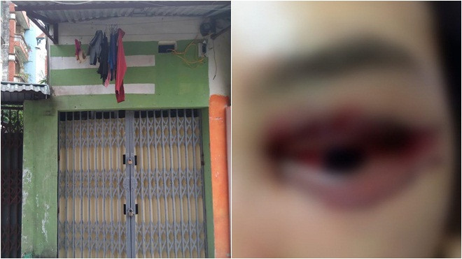 Chủ tiệm đã đóng cửa Spa, tháo biển hiệu sau vụ khách nữ bị hỏng mí mắt Ảnh 2