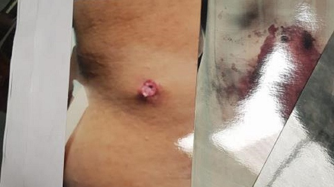 Cán bộ quản lý thị trường rút súng bắn vào người tham gia giao thông Ảnh 2