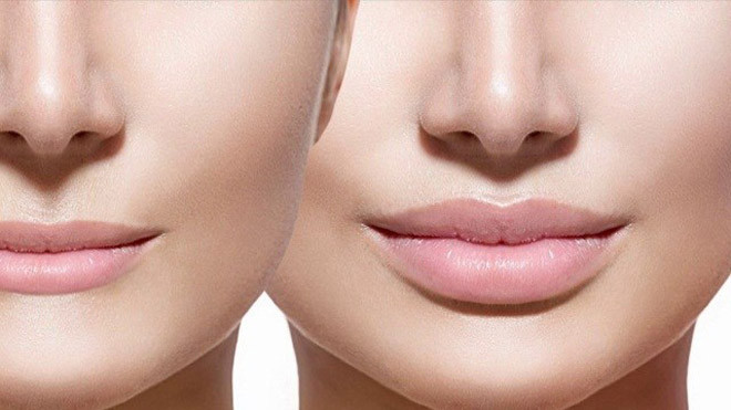 Khắc phục môi to, môi mỏng, hay hai môi không cân đối chỉ bằng mẹo trang điểm nhỏ dưới đây Ảnh 2