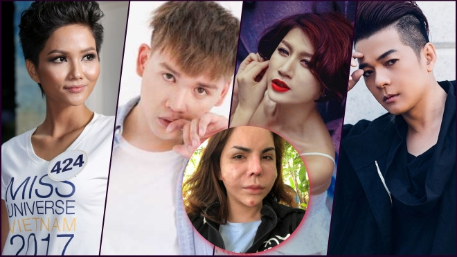 Sao Việt động viên hot girl chuyển giới Linda sau khi công bố ảnh biến chứng phẫu thuật thẩm mỹ Ảnh 2