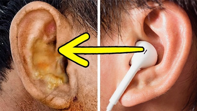 Đây là vật dụng quen thuộc bạn nhất định không nên dùng chung với người khác Ảnh 2