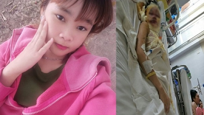 Đã bắt được nghi phạm tạt a xít khiến thiếu nữ 17 tuổi bị hủy hoại khuôn mặt Ảnh 2