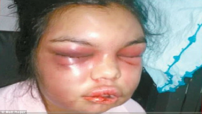 Chồng đánh vợ đến biến dạng mặt mũi mỗi khi có người 'like' ảnh trên Facebook Ảnh 2