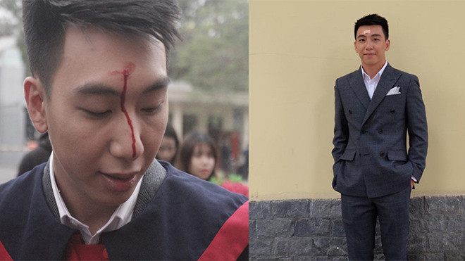 Buổi chụp ảnh kỷ yếu 'đẫm máu' của chàng sinh viên điển trai Ảnh 2