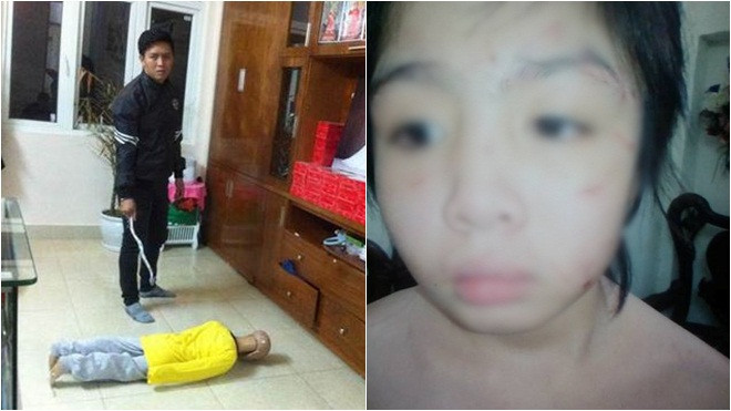 Tạm giữ hình sự người cha đánh đập con trai 10 tuổi gãy xương sườn, rạn sọ não Ảnh 2