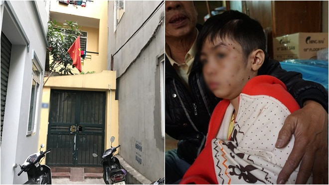 Hàng xóm nơi bé trai bị bạo hành: ‘Phòng trọ đó thường phát ra âm thanh lạ và những tiếng khóc thét’ Ảnh 2