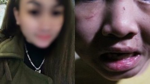 Mẹ kế khai nhận đánh đập bé trai 10 tuổi do bé quá nghịch ngợm Ảnh 2