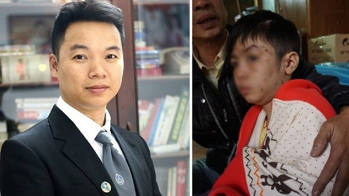 Vụ bạo hành con trai rạn 6 xương sườn: Bố và mẹ kế có thể đối diện 3 năm tù Ảnh 2