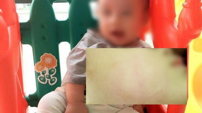 Đưa con đến phòng khám tư, cha bức xúc khi con mới 22 tháng tuổi bị bác sĩ tát vào mặt Ảnh 2