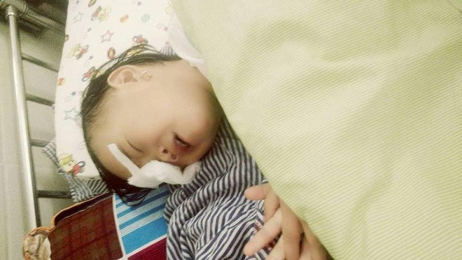 Ngồi chơi ở sân, bé gái 2 tuổi bị gà chọi đá gây nguy cơ hỏng mắt hoàn toàn Ảnh 2