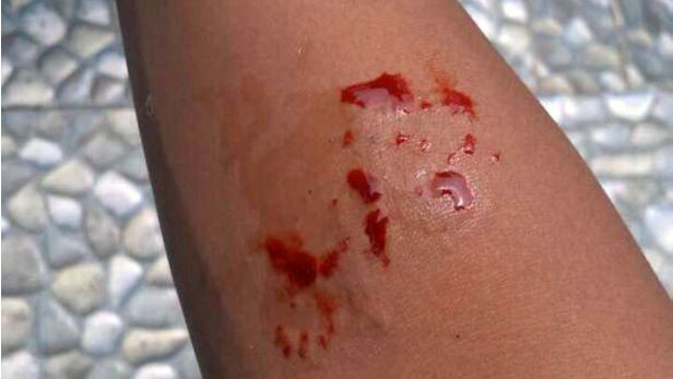 Mải mê chụp ảnh rắn để đăng lên mạng 'sống ảo', thiếu niên bị rắn cắn chết Ảnh 2