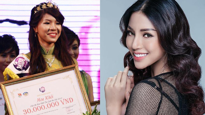 Đập mặt xây lại, nhan sắc giải vàng Siêu mẫu VN Khả Trang thay đổi 180 độ Ảnh 2