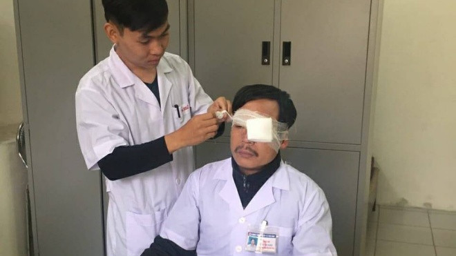 Đang cấp cứu cho bệnh nhân, bác sĩ bị đánh gãy xương sống mũi, chấn thương mắt Ảnh 2