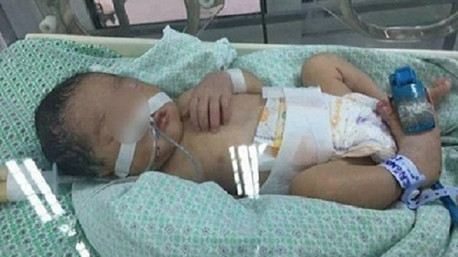 Bé gái 32 tuần tuổi bị mẹ phá thai để chối bỏ được nhóm thiện nguyện cứu sống Ảnh 2