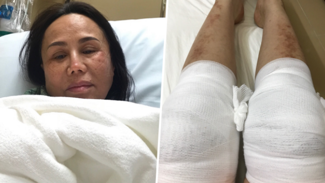 Clip: Danh ca Thanh Tuyền tiết lộ bị tai nạn khi đi diễn, xin lỗi khán giả vì vắng mặt ở liveshow Quang Lê Ảnh 2