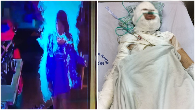 Vụ cô gái bị người đàn ông ngoại quốc tẩm xăng đốt: ‘Con chưa bao giờ kể tôi nghe về người này’ Ảnh 2