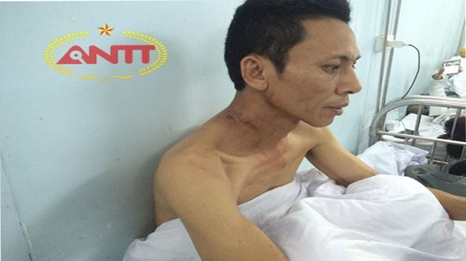 Vào nhà người quen, đâm gia chủ nhiều nhát rồi giật dây chuyền vàng Ảnh 2