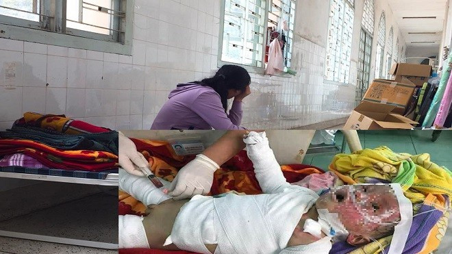 Nỗi đau tột cùng của vợ chồng trẻ bị lửa thiêu rụi nhà cửa: Con gái tử vong, con trai bỏng nặng Ảnh 2