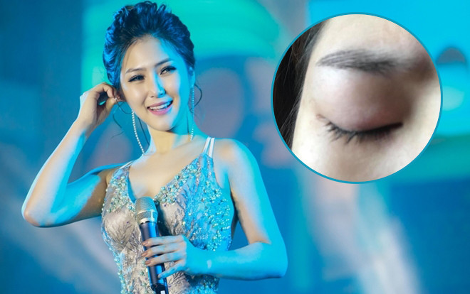 Hương Tràm tiết lộ vẫn chưa được phẫu thuật do mắt bị tổn thương nặng Ảnh 2